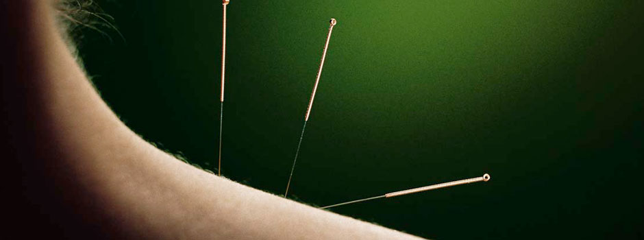 Accredited Acupuncture Of Sacramento